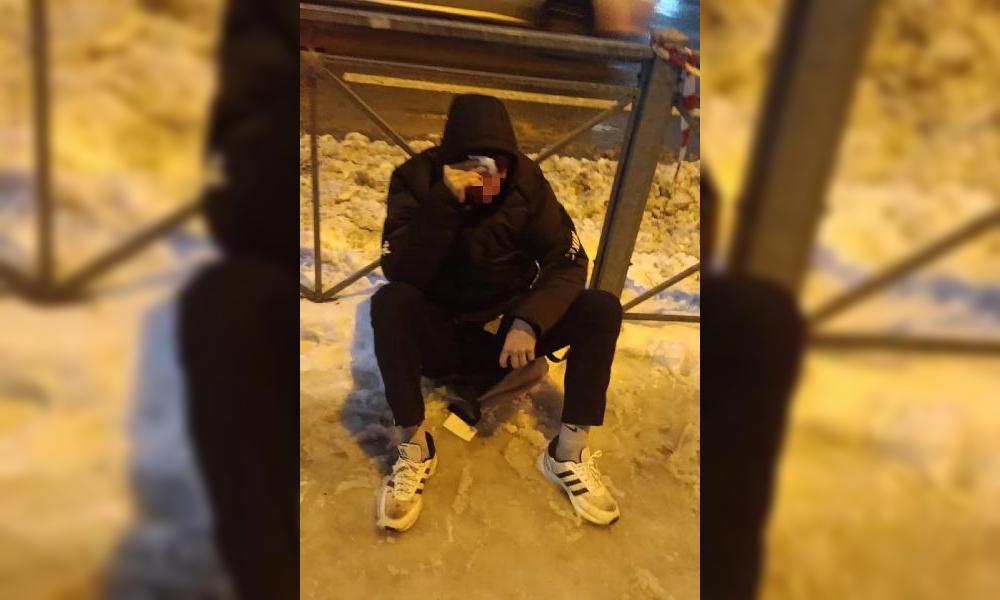 Сосулька рассекла подростку голову и травмировала плечо женщине на Шкапина